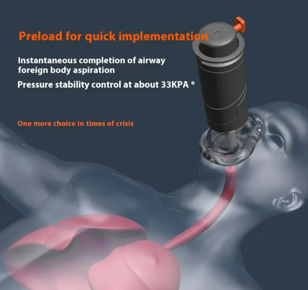 LifeGuard Emergency Anti-Choking Suction Device – Instant Airway Rescue